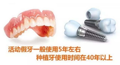 种植牙价格风云变幻：你了解最新的市场动态了吗？