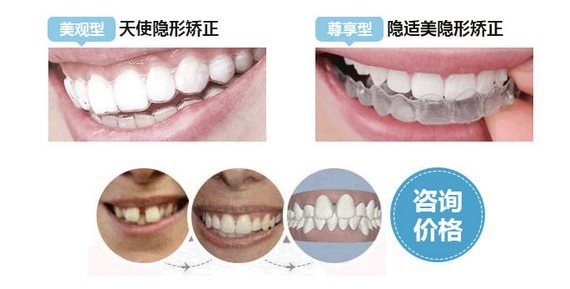 做牙套的原理_牙齿矫正的原理,原来牙套是这样移动的(2)
