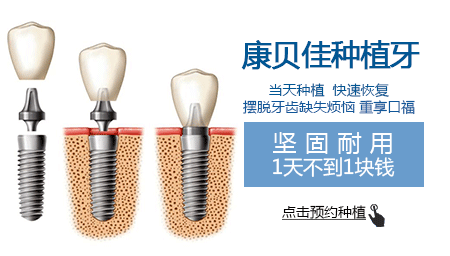 种植牙可以用医保报销吗