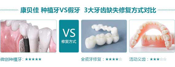 50岁装一口假牙多少钱