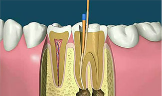 12-1Z602162102158.jpg